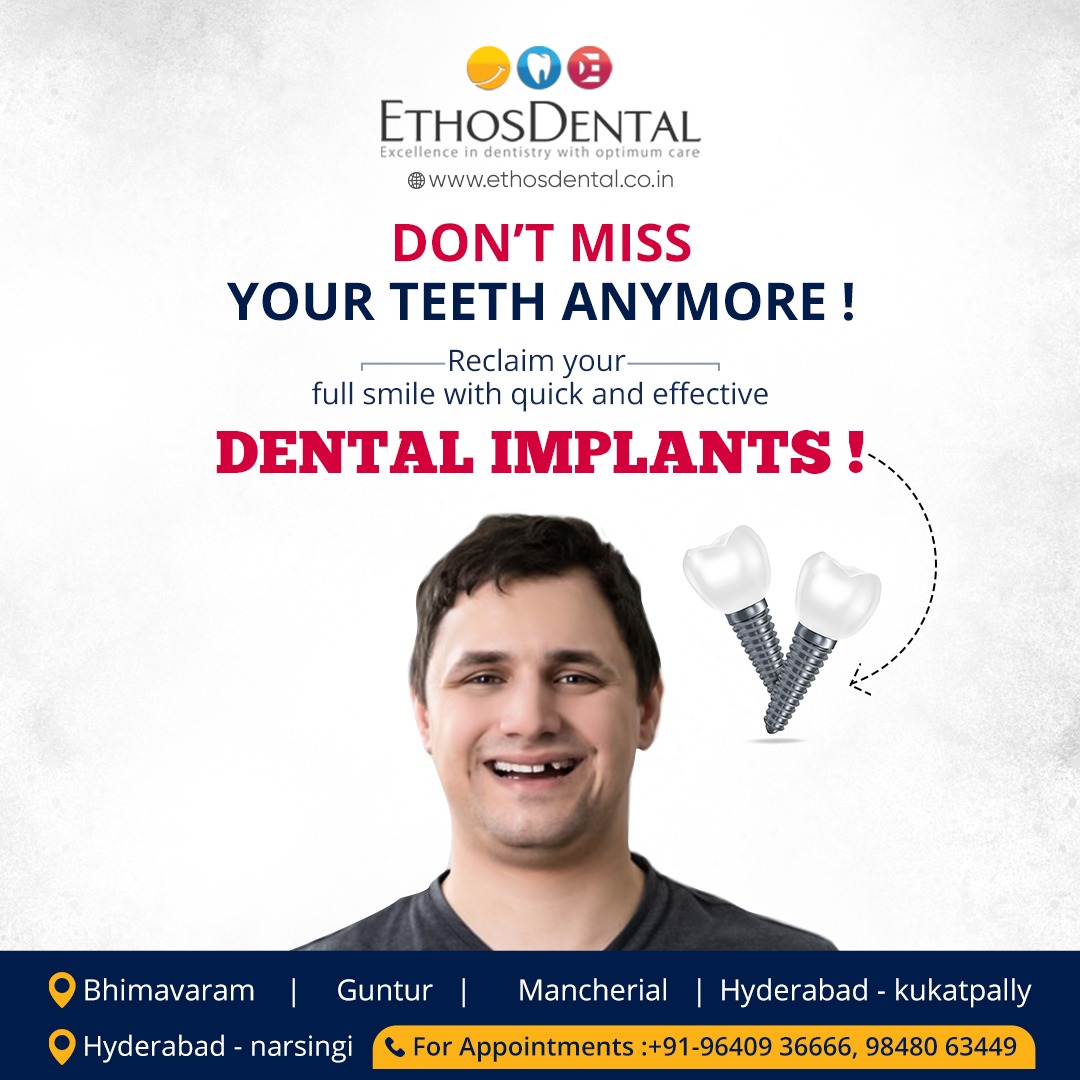dental implants